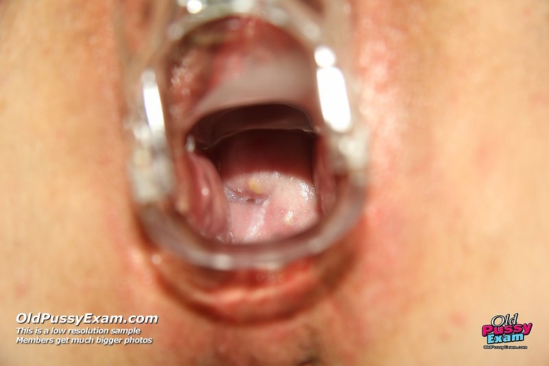 /content/old-pussy-exam/galleries/zita-elder_nurse_toy_on_gynochair-072011/full/14.jpg